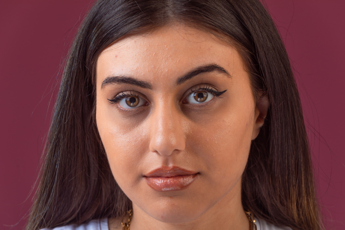 How to Get Rid of Dark Spots