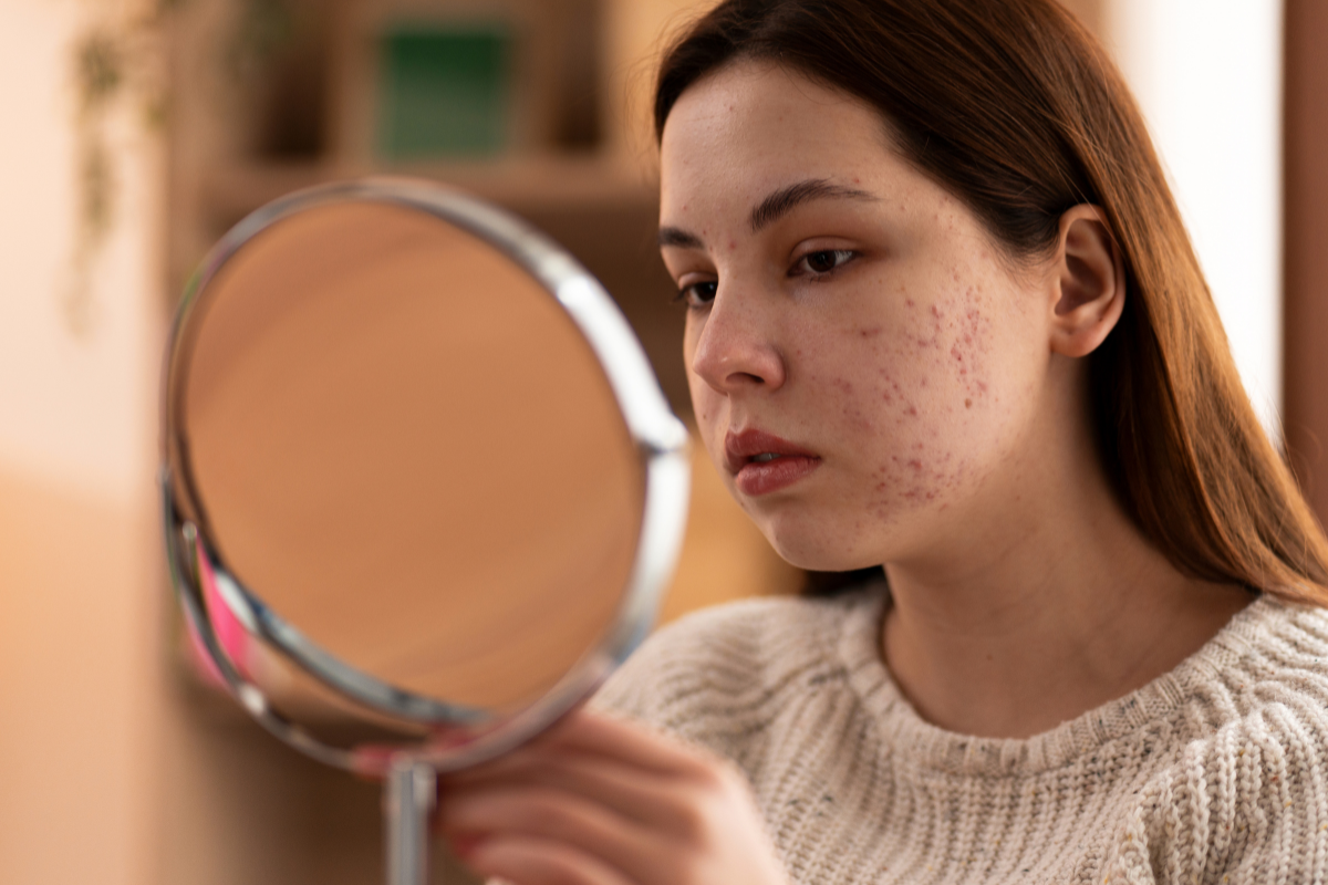 8 Common Skin Concerns